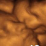 Ultrasound lovers Profile Picture