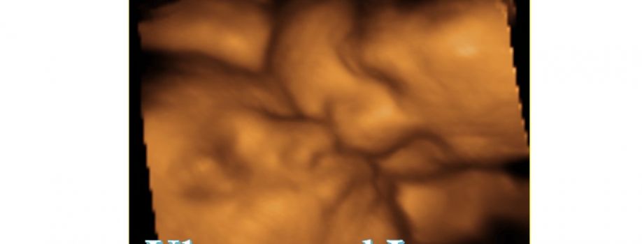 Ultrasound lovers Cover Image